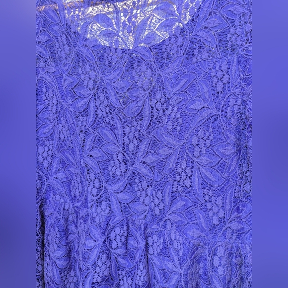 Free People Shake It Up Lace Dress‎ In Blue Size Medium Spring Summer - Picture 6 of 8